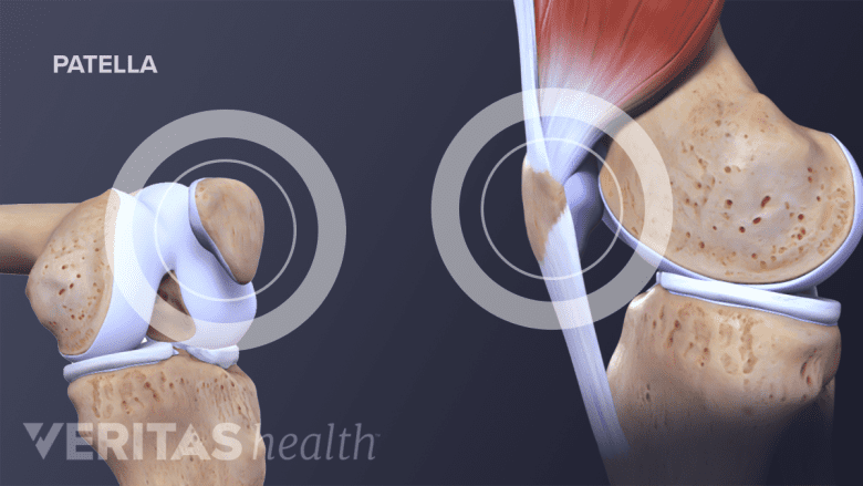 illustration showing anatomy of knee joint labelling patella(kneecap).