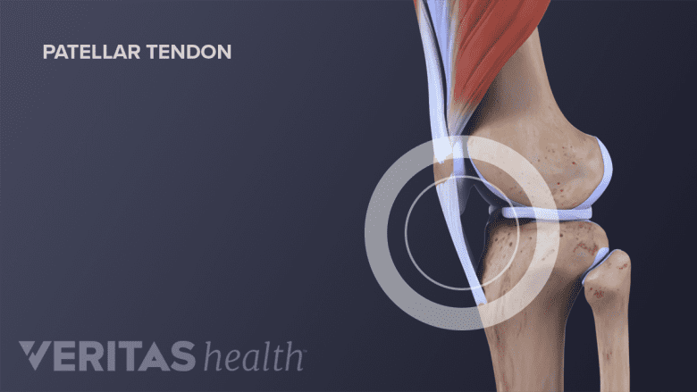 The Patellar tendon.