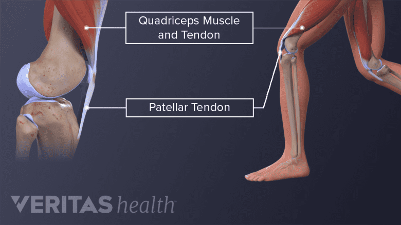 Knee anatomy showing the quadriceps muscle and tendon and patellar tendon