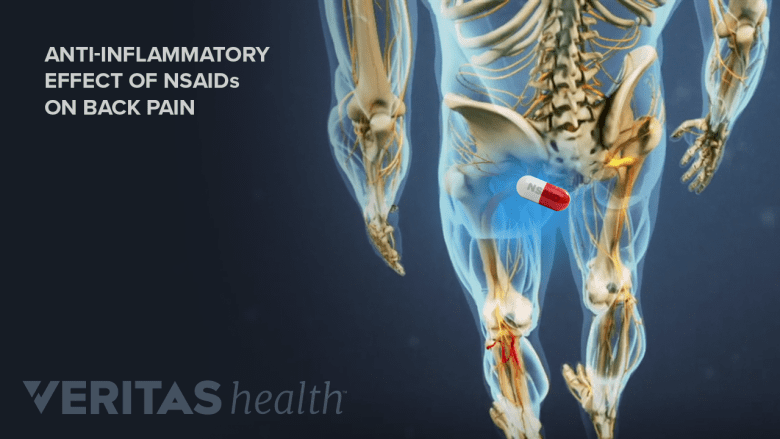 Illustration showing effects of NSAIDs on low back pain.
