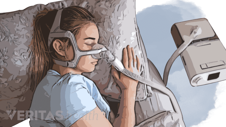 Woman sleeping with a c-pap mask.