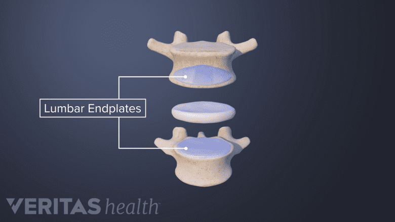 endplates between two vertebra