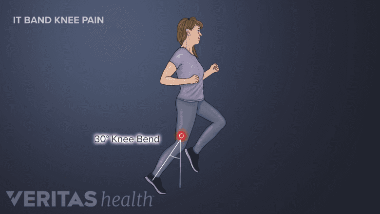 Illustration showing a woman jogging with her knee bent at 30 degree angle.