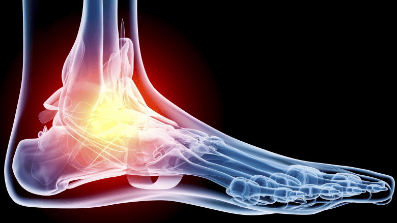 X-ray of the bones of the foot.