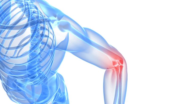 Pain from elbow bursitis.