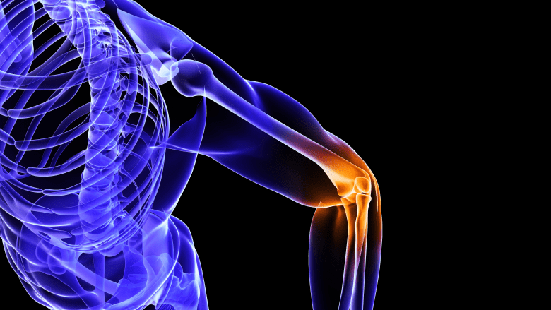 Pain from bursitis occuring in the elbow.