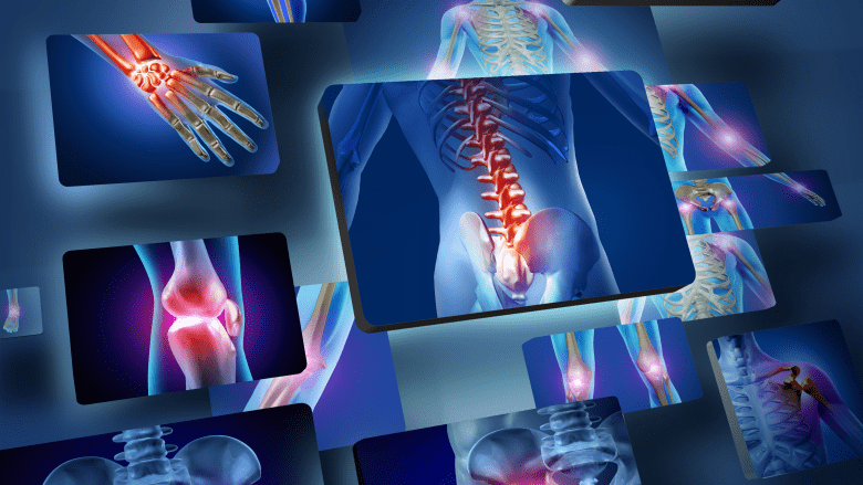 Various x-rays of injured body parts.
