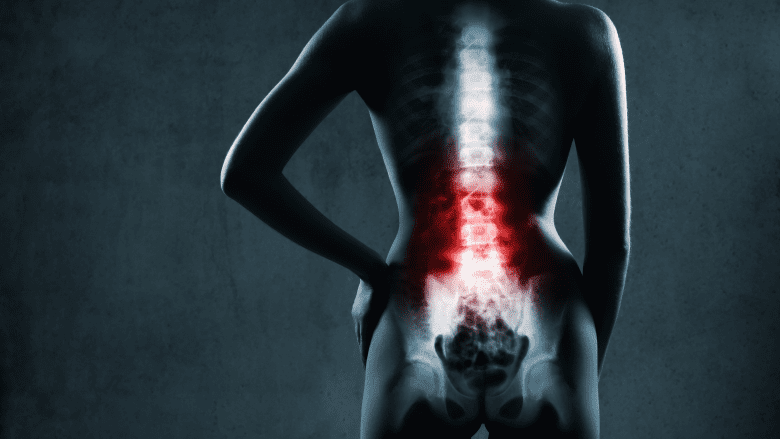 X-ray of a patient with lower back pain.