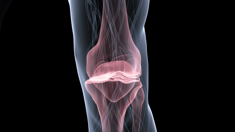 Pain occurring in the knee.