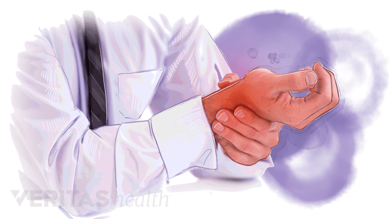 An illustration showing a hand with a red hue around it.