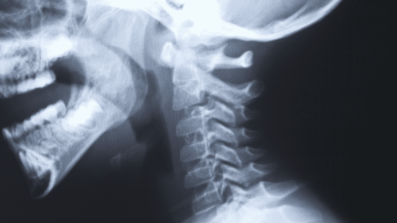 Medical illustration showing head and neck x-ray.
