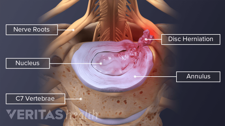 C6 Function All About the C6-C7 Spinal Motion Segment | Spine-health