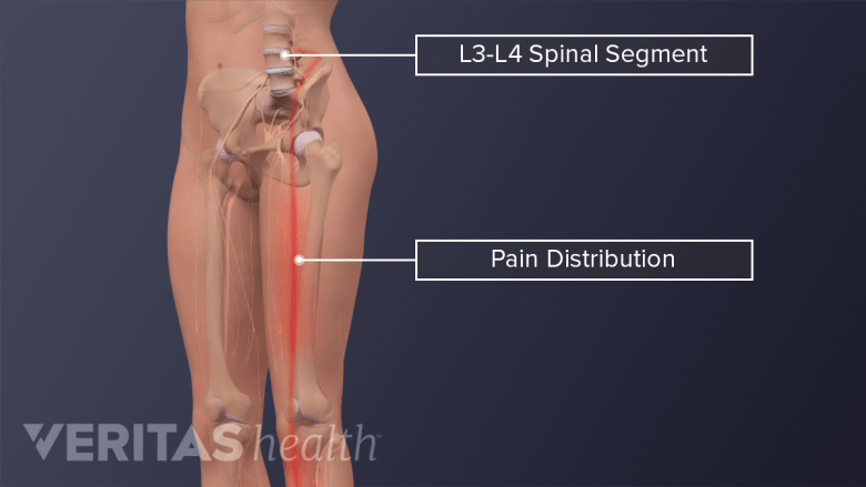 All About The L3 L4 Spinal Segment Spine health All About The L3 L4 Spinal Segment Spine health