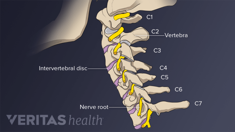 C6 Radiks What Is Cervical Radiculopathy? | Spine-health