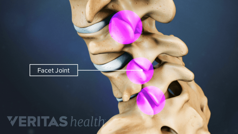 Spinal Cord Conditions with Sciatica Symptoms | Spine-health