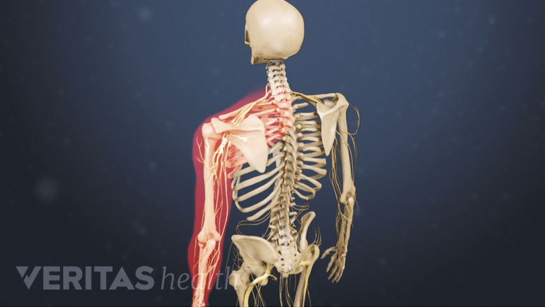 What Is Cervicogenic Headache? | Spine-health