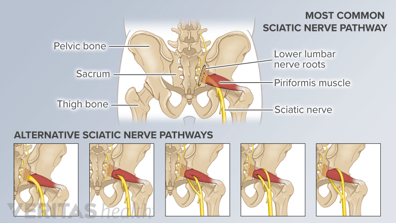 Sciatic Window Sciatic Nerve Anatomy | Spine-health