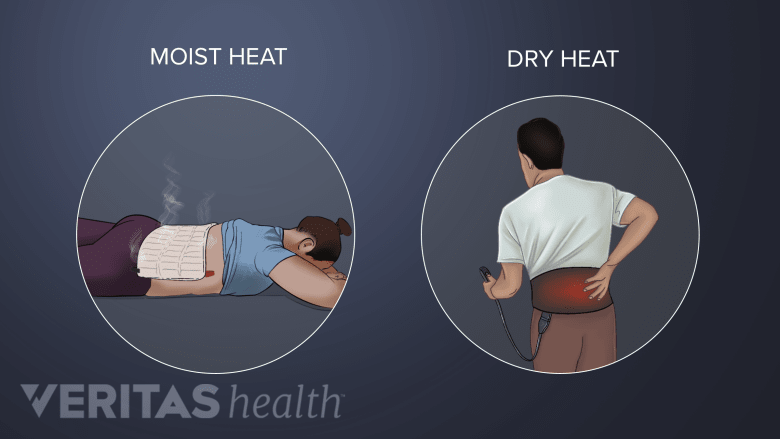 How to Apply Heat Therapy | Spine-health