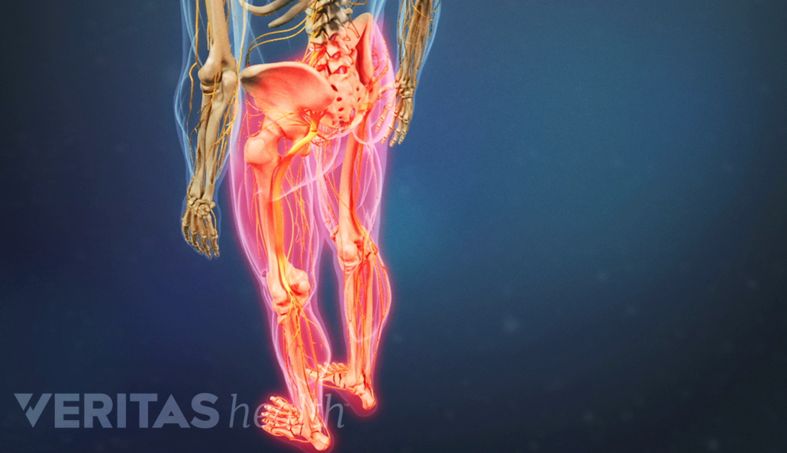 An illustration showing numbness and weakness in both legs.