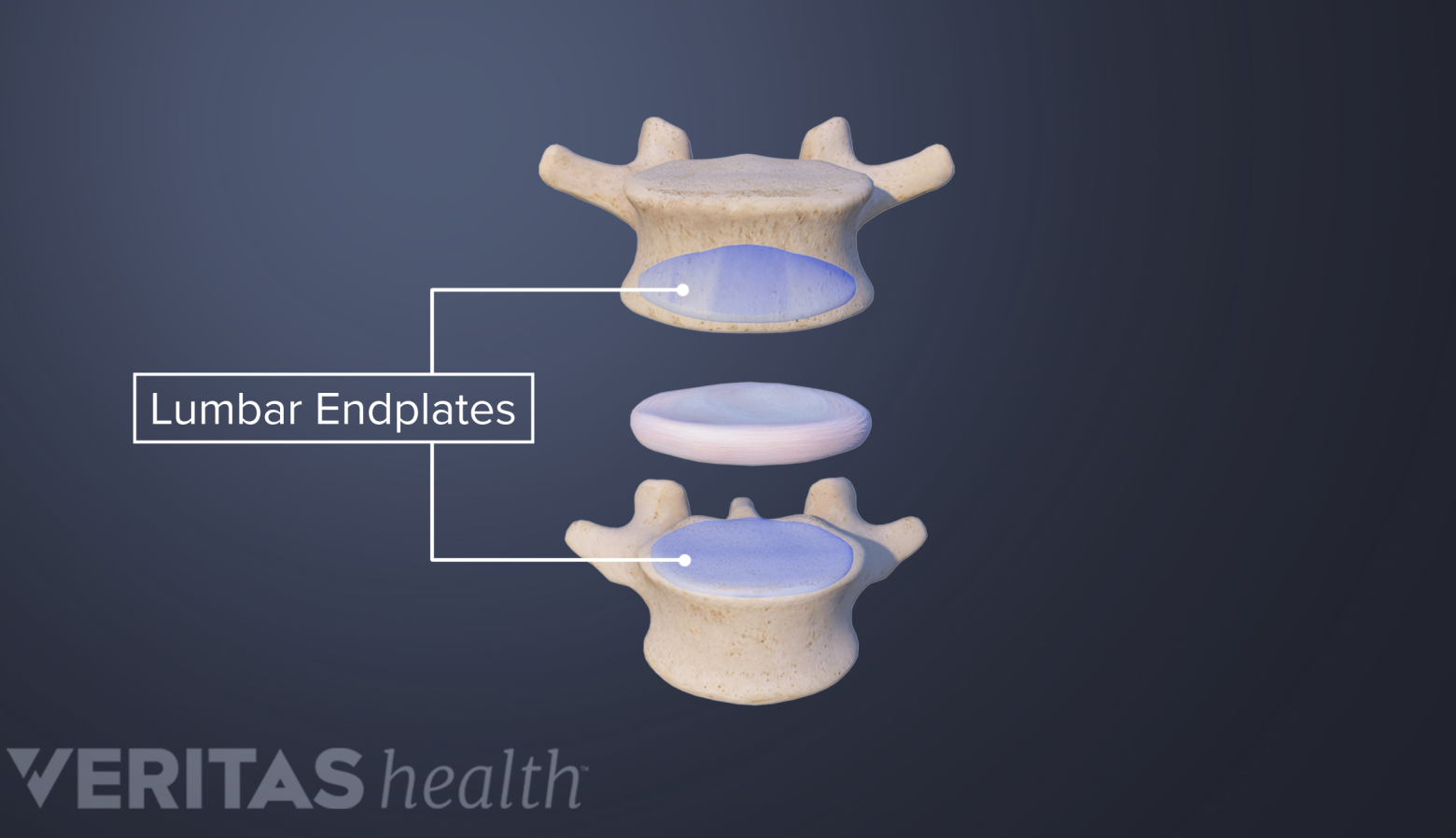 Lumbar Discs | Spine-health