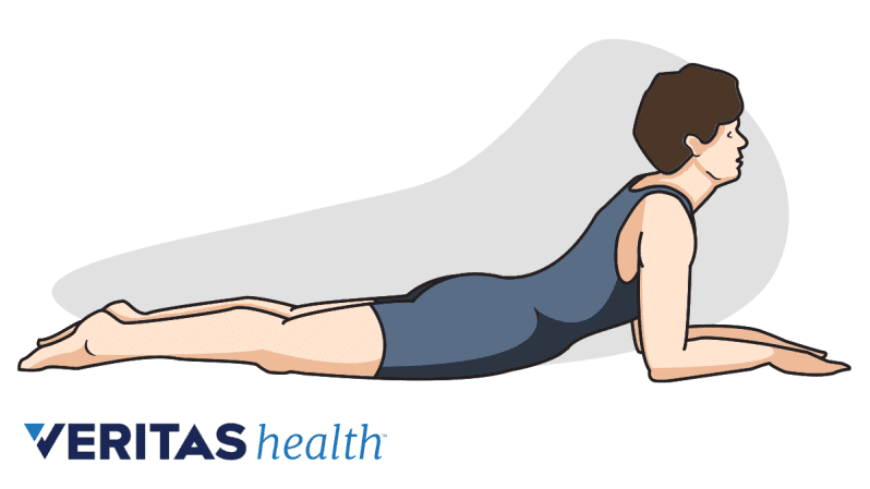 Woman performing the McKenzie prone press-up