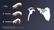 Different shapes of the shoulder acromion: flat, curved, and hooked