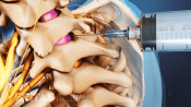 Epidural Steroid Injection