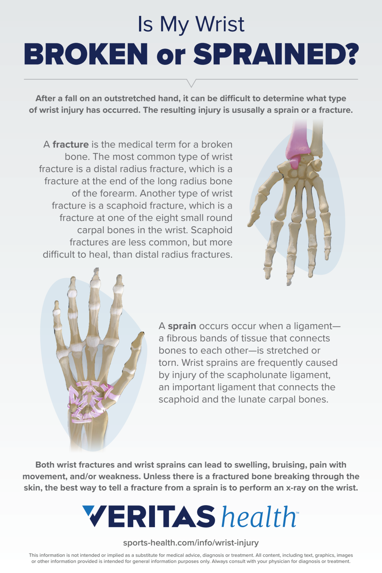Is My Wrist Broken Or Sprained Infographic | Sports-health
