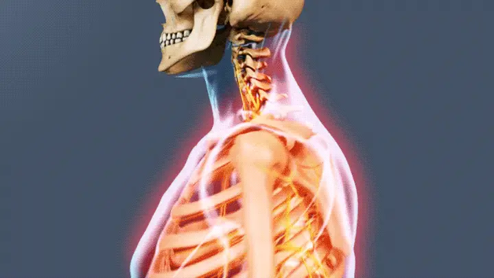 how-cervical-radiculopathy-causes-pain-numbness-and-weakness-7-4