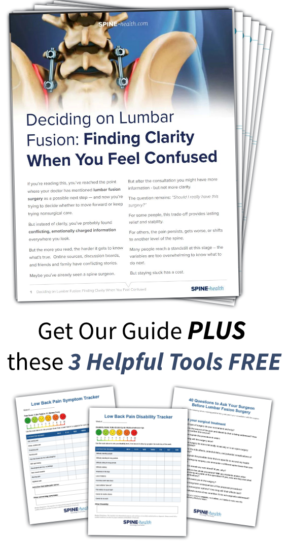 Deciding on Lumbar Spinal Fusion guide cover
