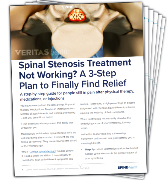 What Happens After Lumbar Fusion recovery guide cover