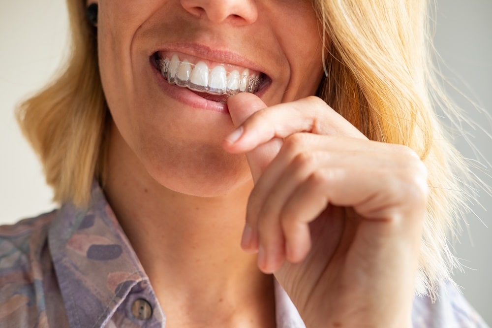 Invisalign Comprehensive