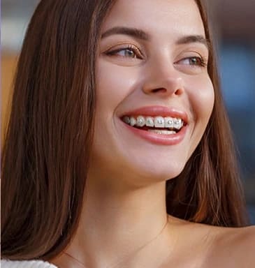 braces