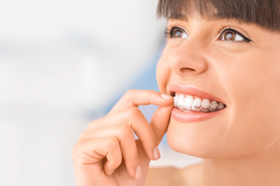 Invisalign Moderate