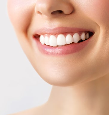 teeth-whitening