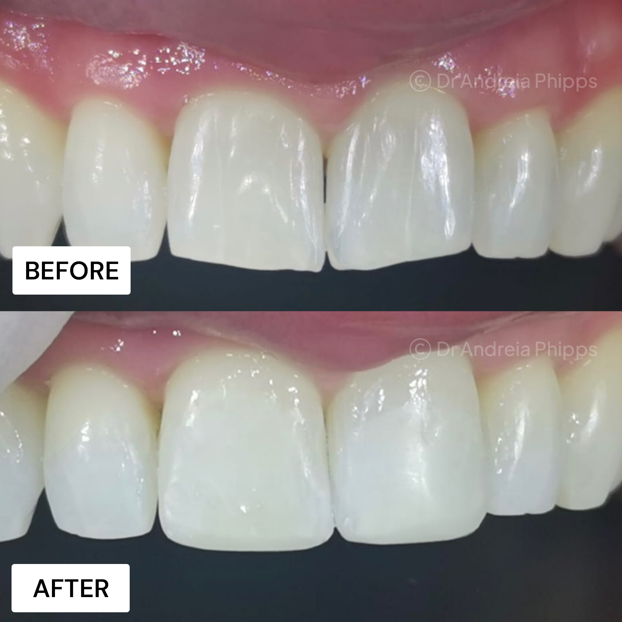 Transformation Case 52