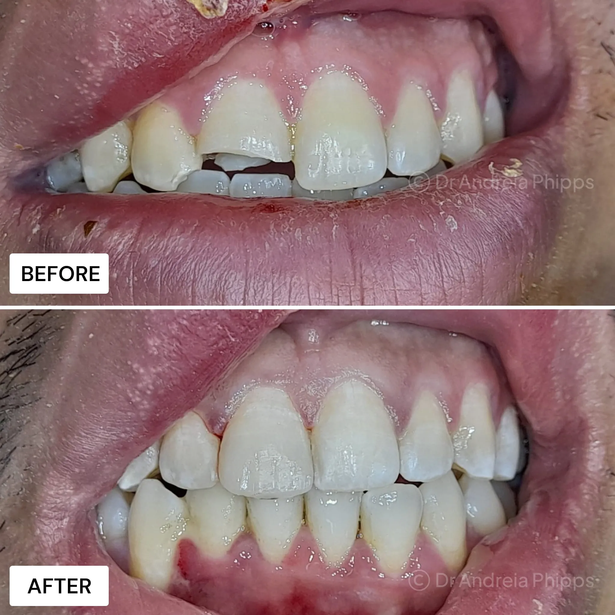 Transformation Case 35