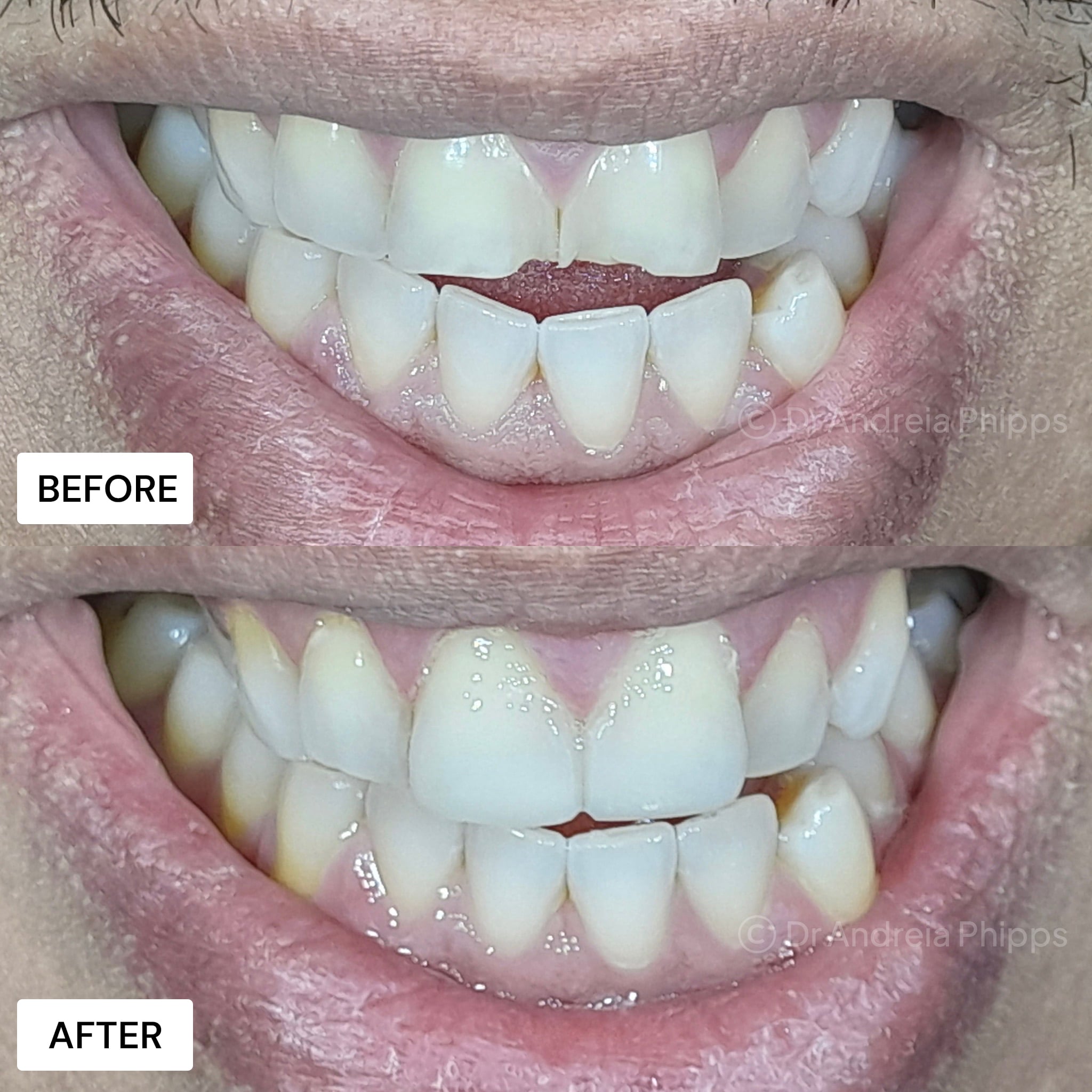 Transformation Case 31