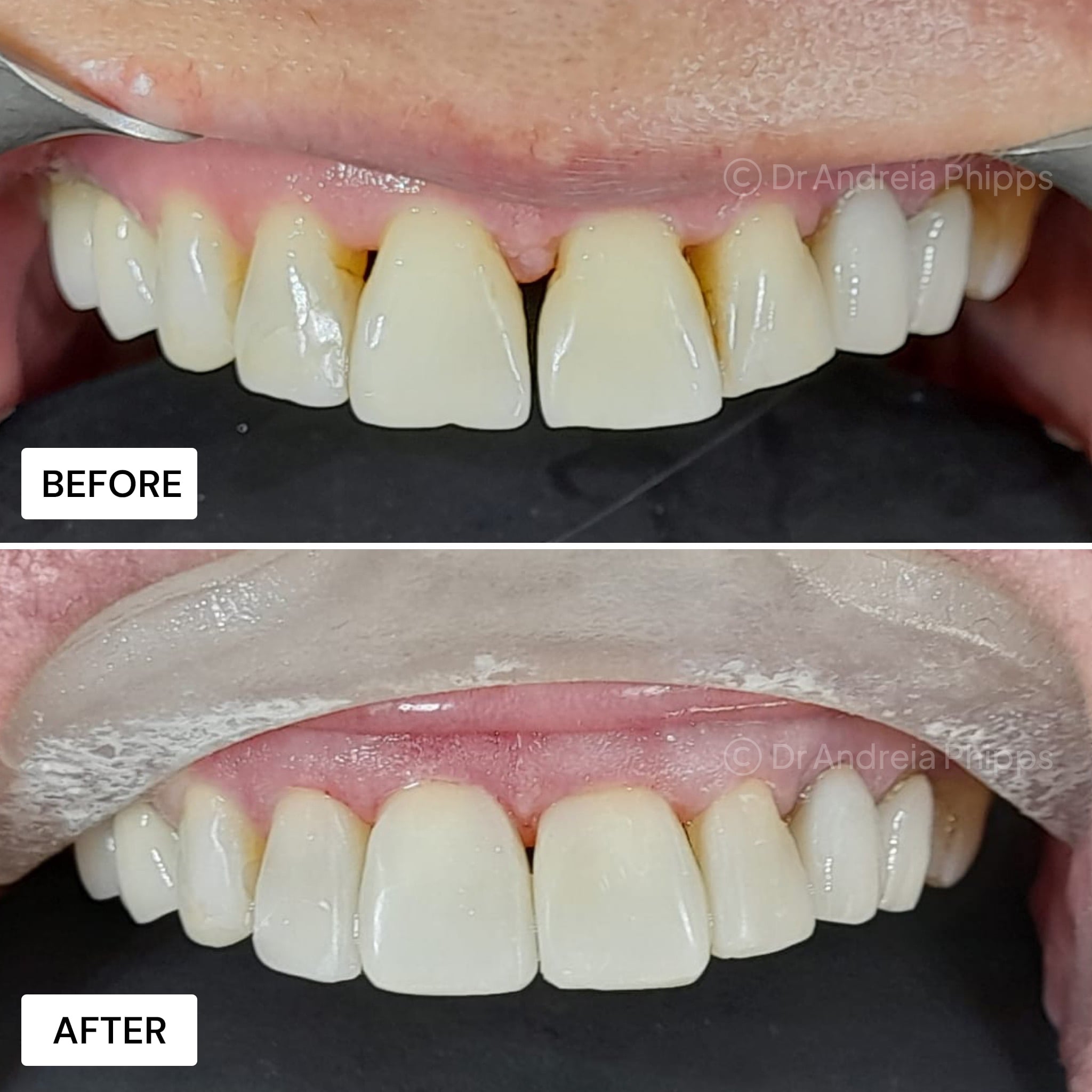 Transformation Case 29