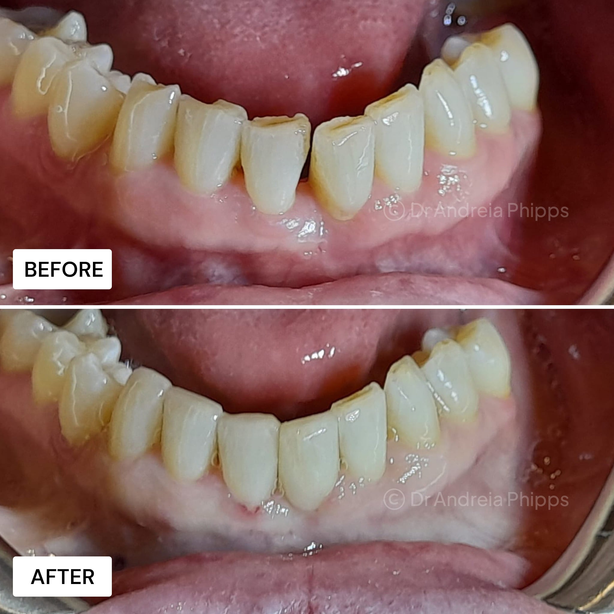 Transformation Case 26