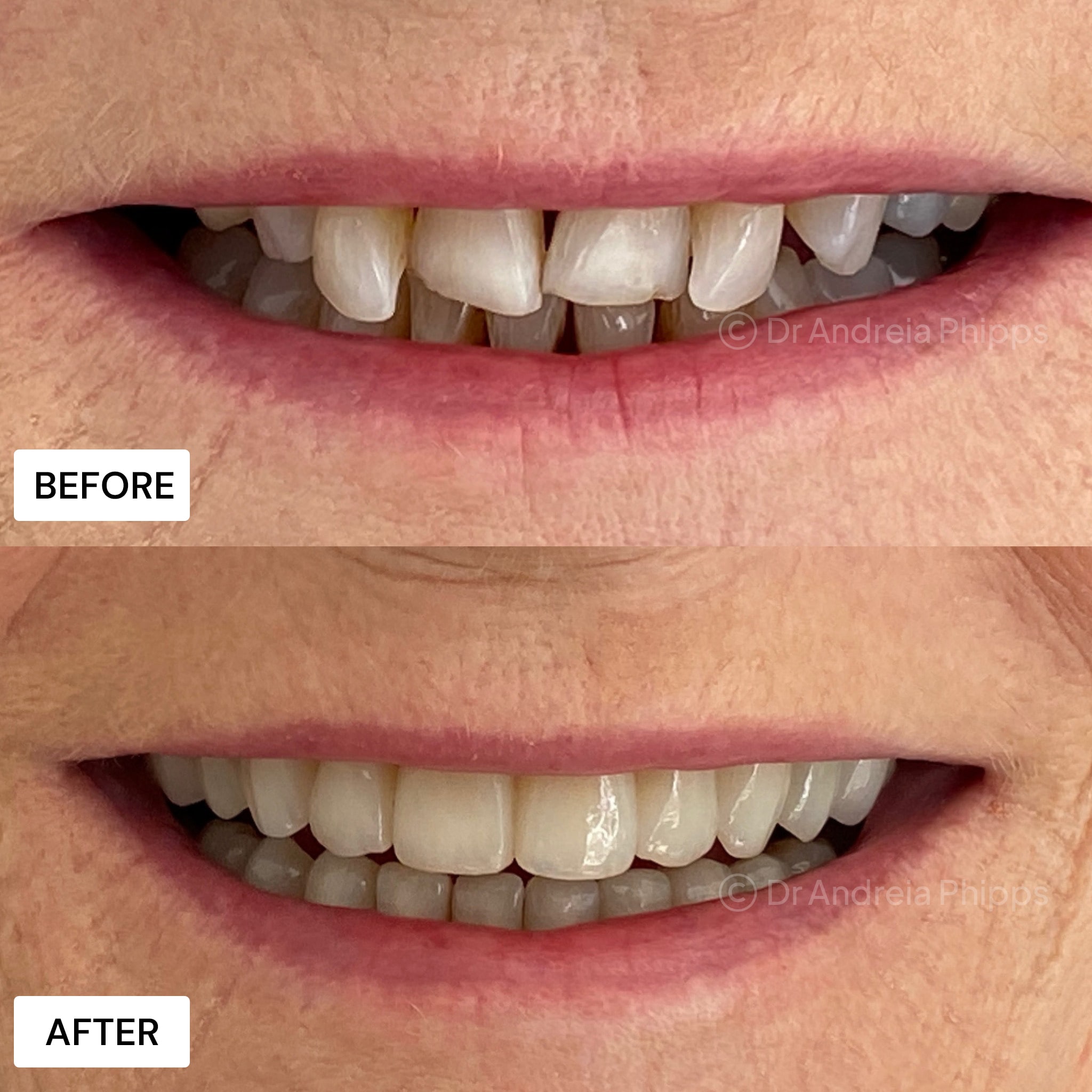 Transformation Case 23