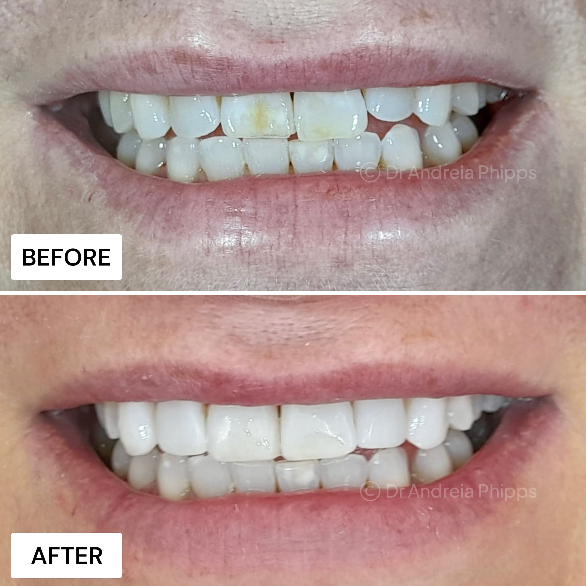 Transformation Case 22