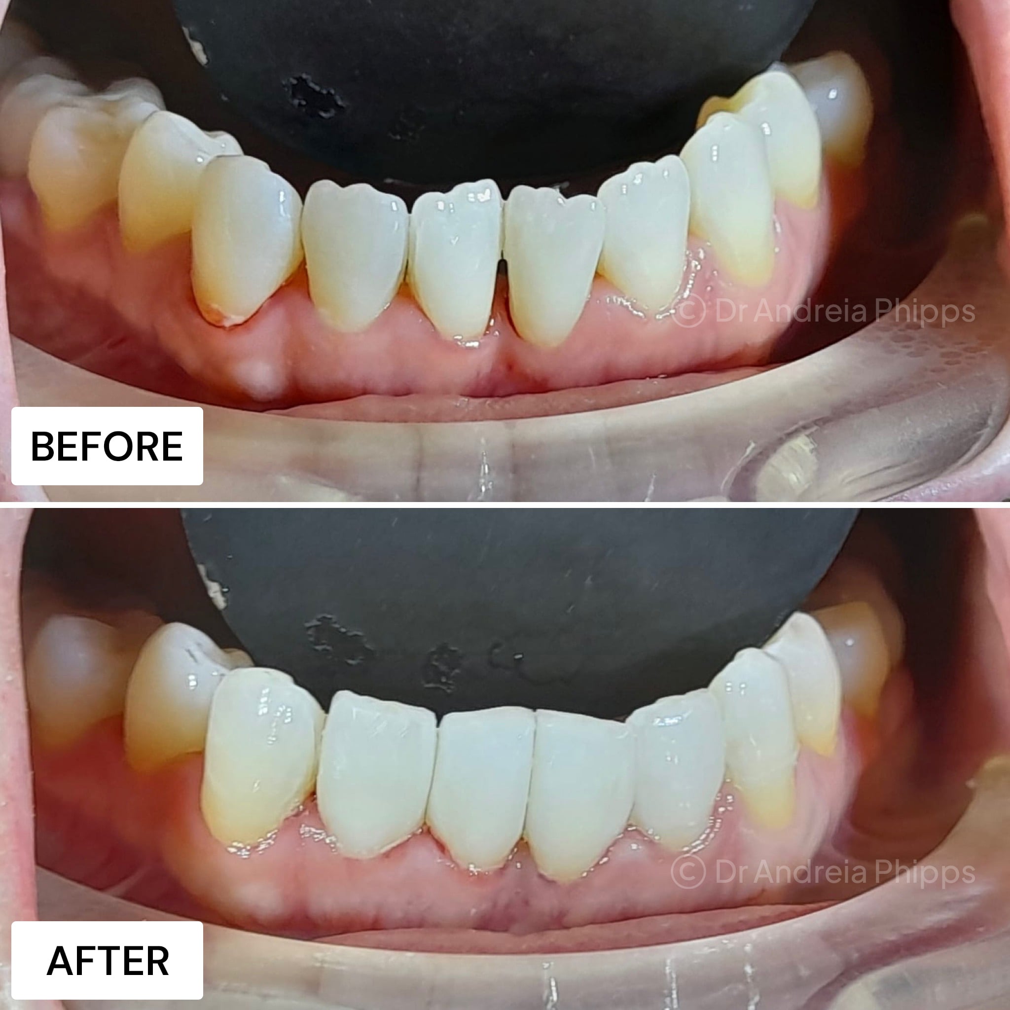 Transformation Case 19