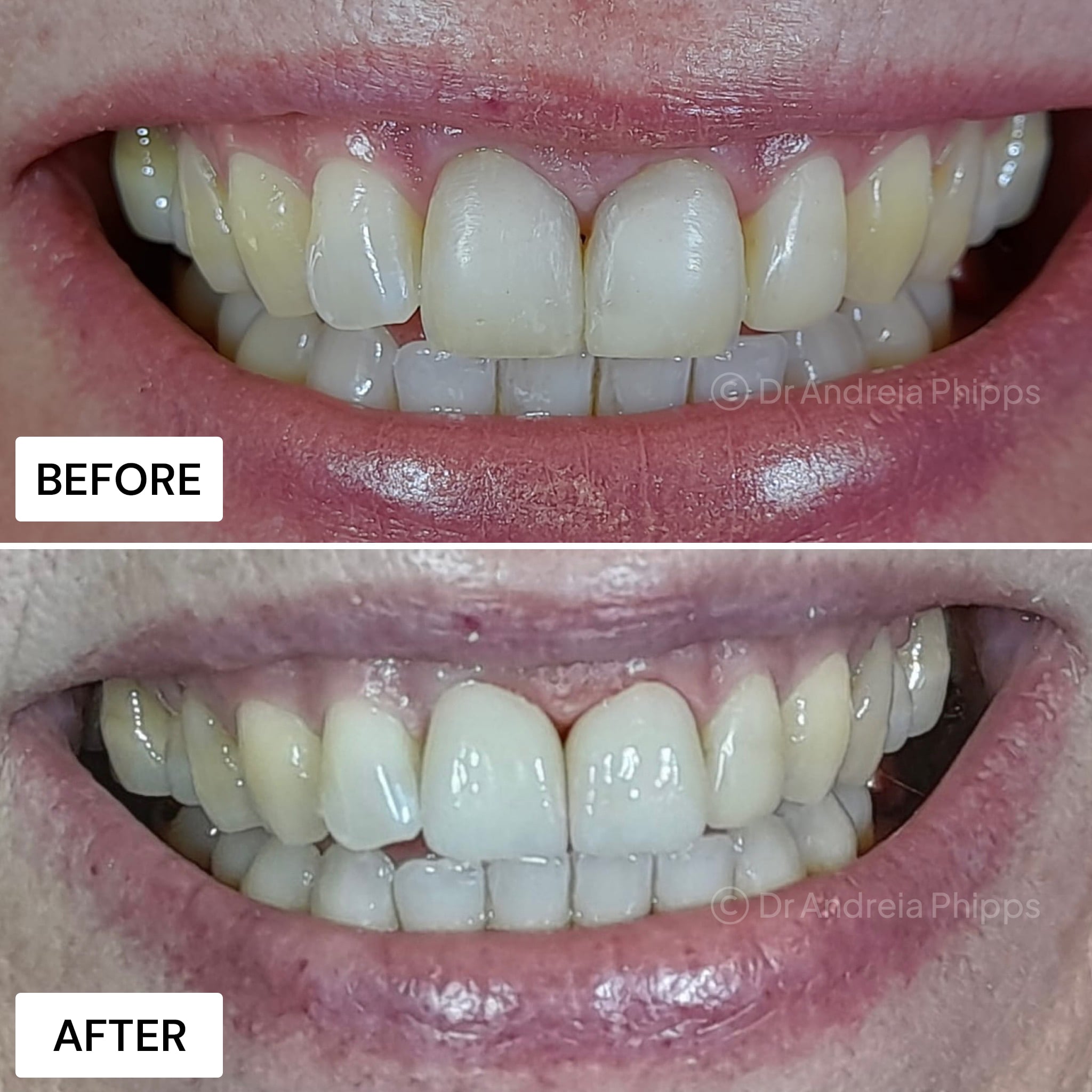 Transformation Case 18