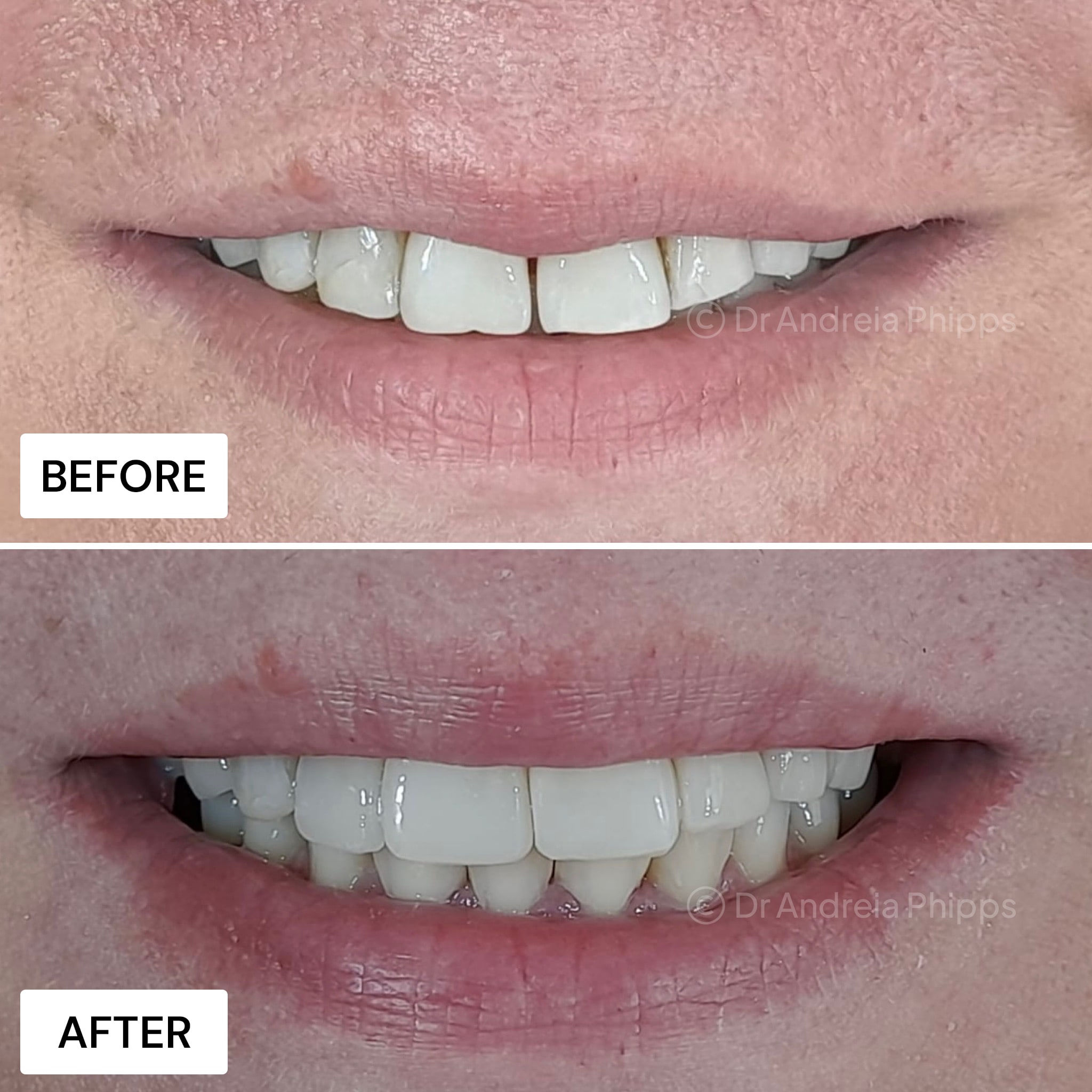 Transformation Case 16