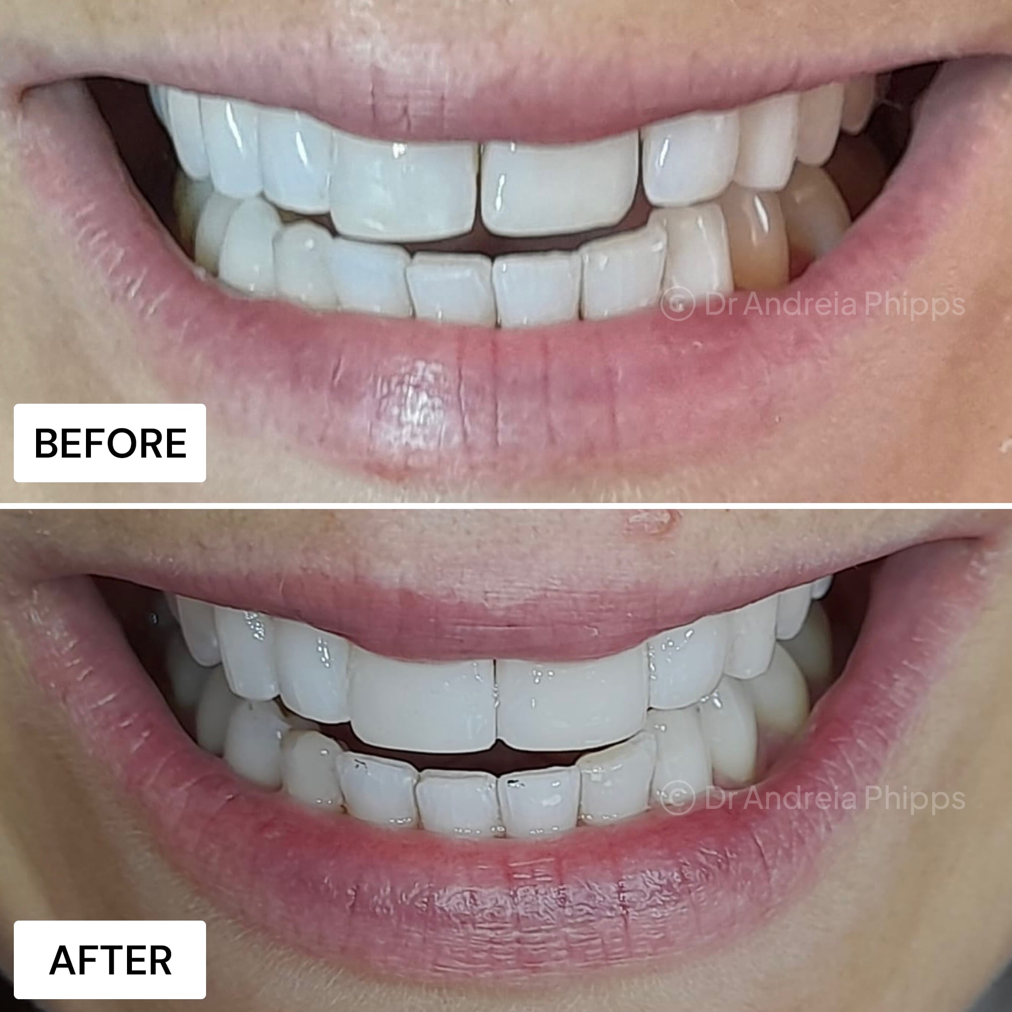 Transformation Case 14