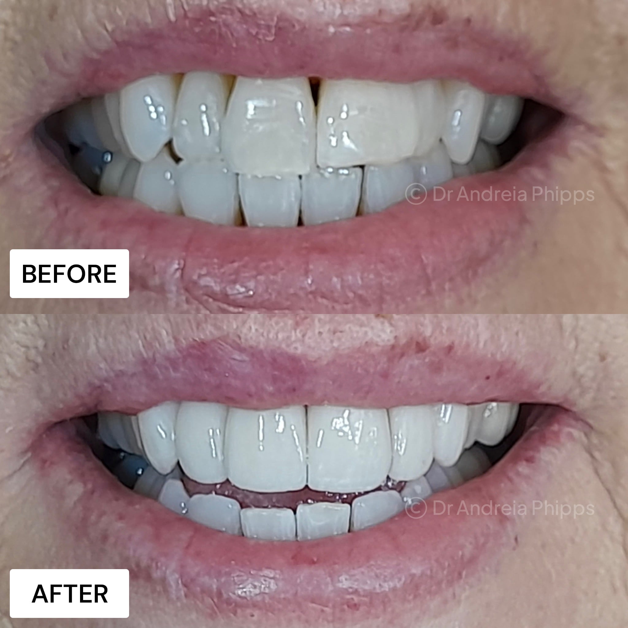 Transformation Case 13