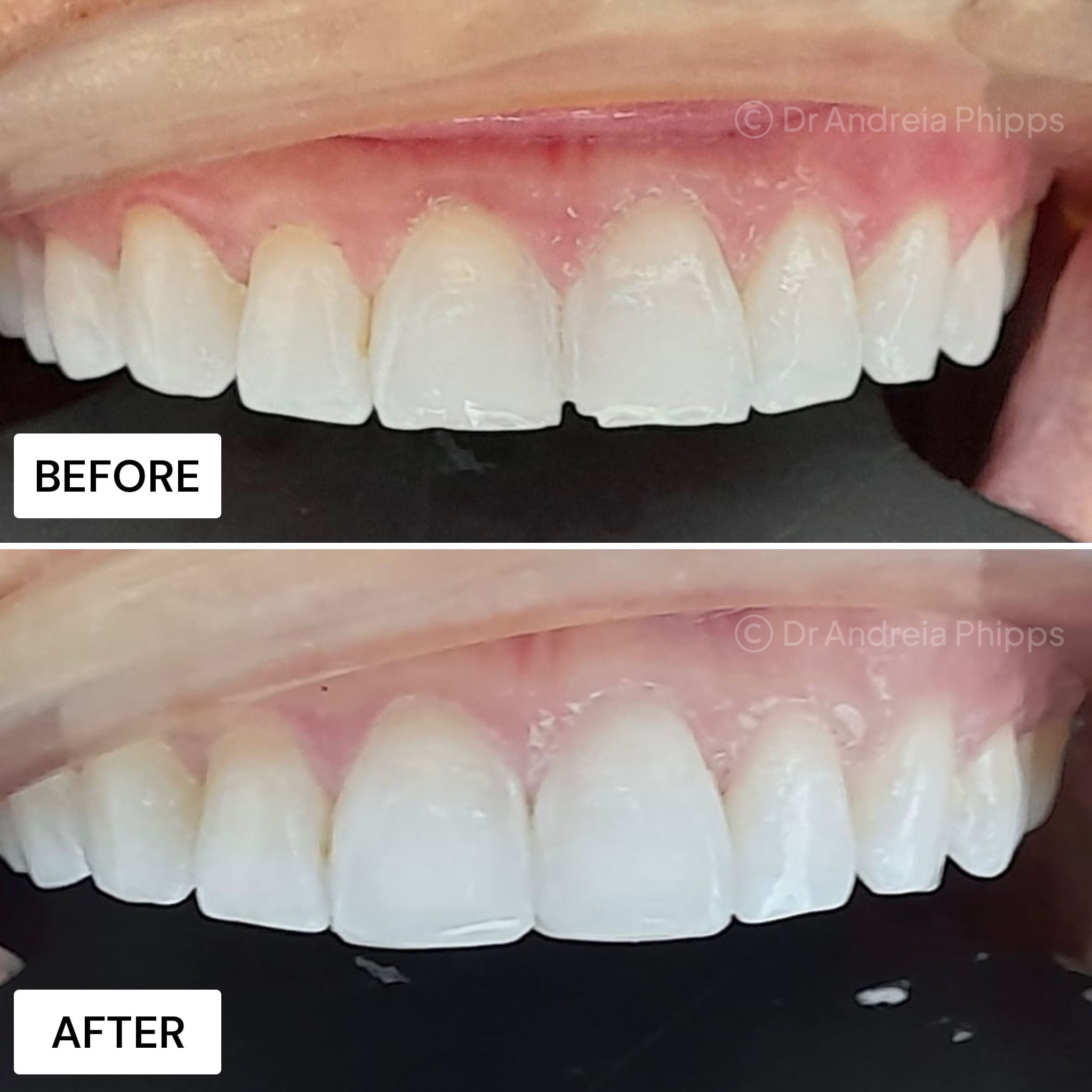 Transformation Case 11