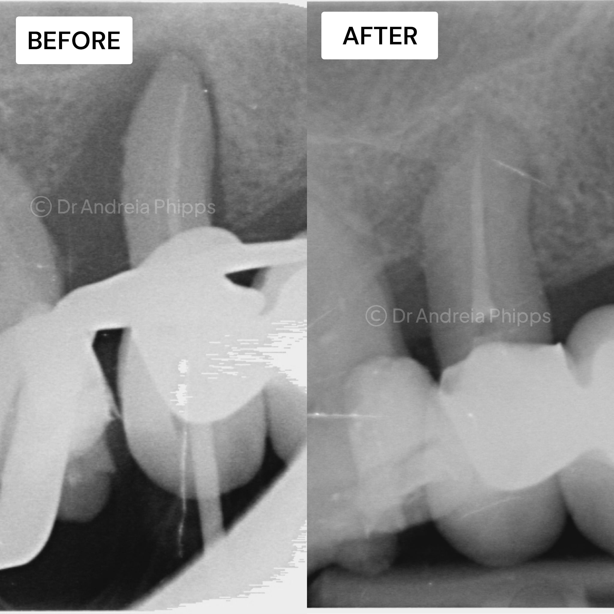 Transformation Case 9