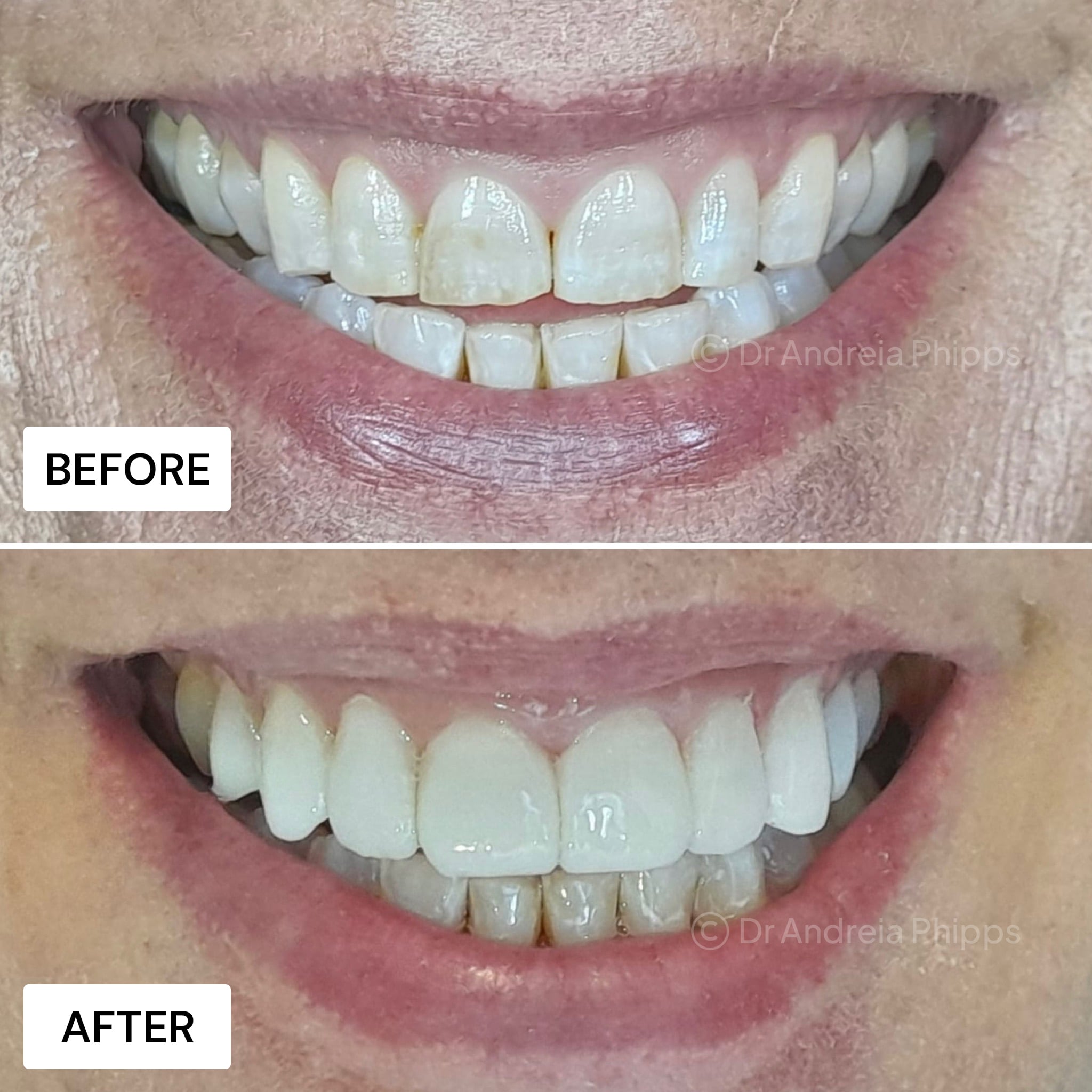 Transformation Case 8